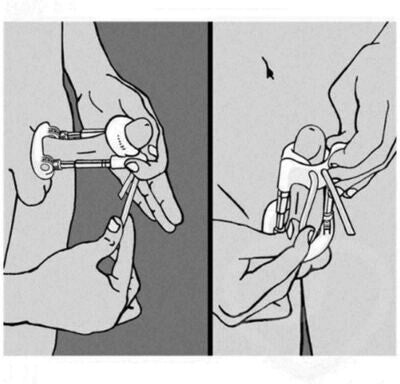 Pro Extender Penis Enlarger System